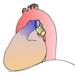 Animated view of TEE: CLICK TO START